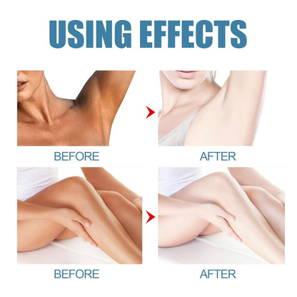 SkinLumy™ Exfoliating Whitening Cream (Pack of 2)